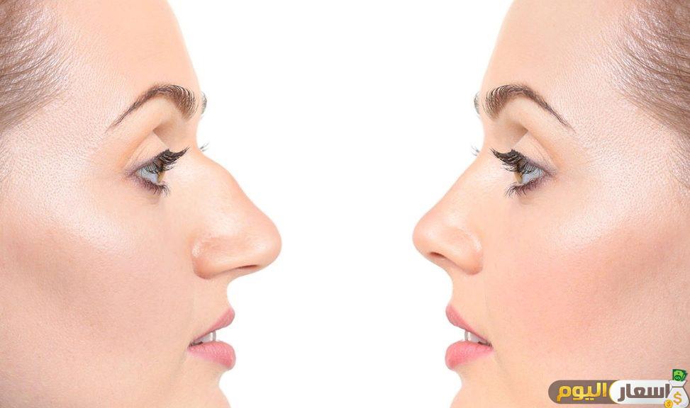 اسعار عمليات تجميل الانف