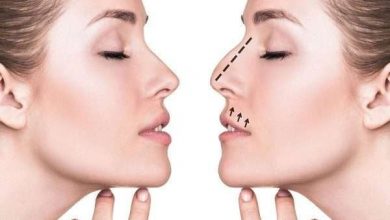 Photo of أسعار عمليات التجميل في المغرب 2026